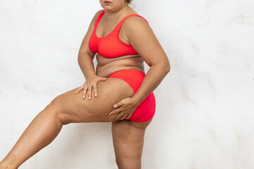 Overweight woman standing sideways massage raised thigh by hands, free copy space, white...