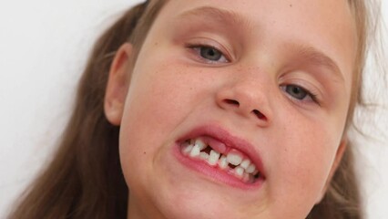 Video shot of small little blond girl with ponytails showing toothless mouth with milk teeth, open and grinning. Milk teeth treatment, tooth loss and health checking and monitoring. Dental care