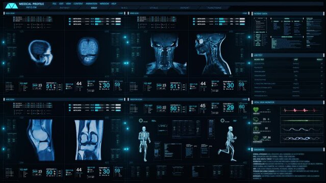 Futuristic Technological Interface Analyzing human anatomy and Morphology. Medical Profile of Patient Showing Knee, Head and Neck MRI Scan, 3D Model Animation Running and Vital Signs. Healthcare.