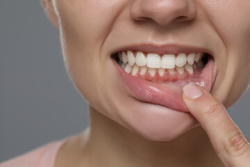 Woman showing healthy gums on gray background, closeup