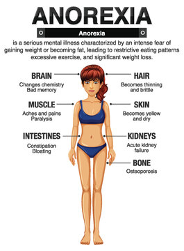 Anorexia (Anorexia) and Its Effects on the Body
