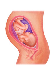 Baby position for labour and birth, Optimal fetal positioning