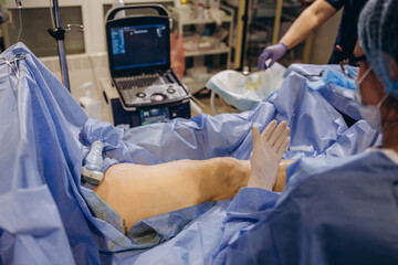 Obraz premium Varicose veins surgery act, superficial veins problems, swollen skin