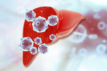 Hepatitis virus infection in human liver. 3d illustration.. - obrazy, fototapety, plakaty