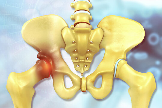 Human hip anatomy. Femoral head pain. 3d illustration.