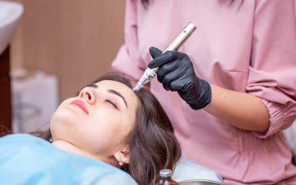 Treatment of the scalp for hair loss, alopecia. A trichologist doctor makes a dermapen procedure on the patient's head. Vitamin injections to improve hair growth.