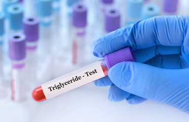 Doctor holding a test blood sample tube with Triglyceride test on the background of medical test tubes with analyzes