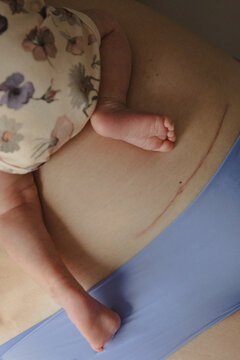 little newborn baby lying on mothers naked belly with cesarean scar
