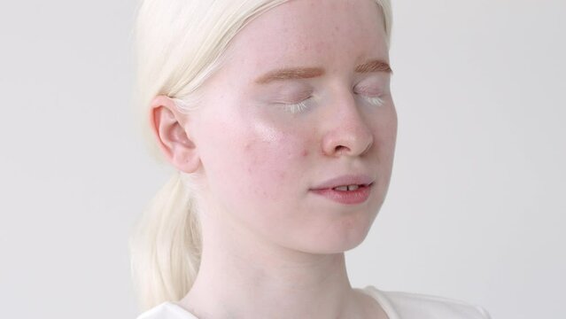 Beautiful albino teen girl, cute pretty model on white studio background. Inclusive unusual natural beauty, inclusion, albinism and diversity, skin care concept. Close up face portrait.