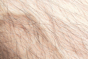 Macro human skin and hair,Hair on the body of the macro 