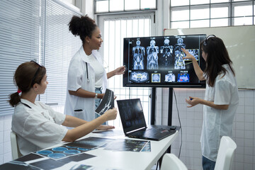 Group of female medical scientists meeting in brain research lab by monitor showing MRI, CT scans...