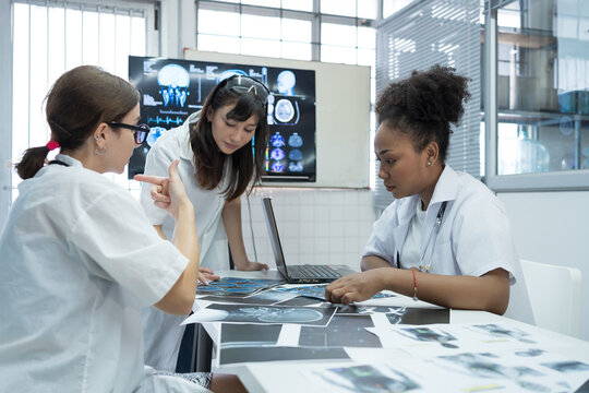 Group of female medical scientists meeting in brain research lab by monitor showing MRI, CT scans brain images. Group of doctors discuss treatment for brain patients, showing images on monitor