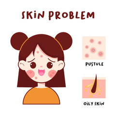 vector illustration of oily and acne face problems
