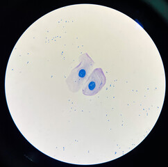 Squamous epithelial cell in sputum AFB.