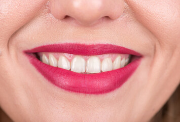 Happy Woman Face With Pretty Smile and White Teeth. Studio Photo Shoot. Use Bright Red Lipstick.