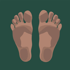 Vector isolated illustration of human feet. Fungus treatment.