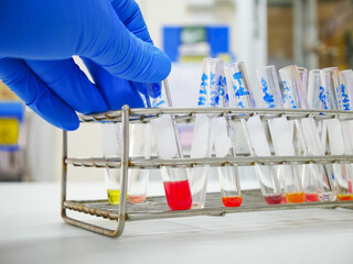 Scientist testing blood grouping in laboratory.