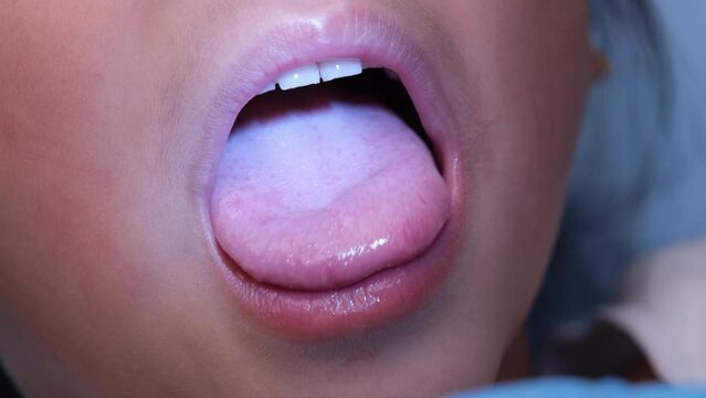 Close-up inside the oral cavity of a healthy child with beautiful rows of baby teeth. Young girl opens mouth revealing upper and lower teeth, hard palate, soft palate, dental and oral health checkup.