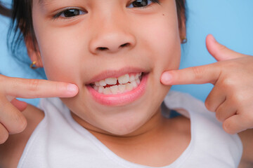Close-up of young girl touching the corners of her mouth with index finger while smiling broadly revealing her beautiful white teeth on blue background. Concept of good health in childhood.