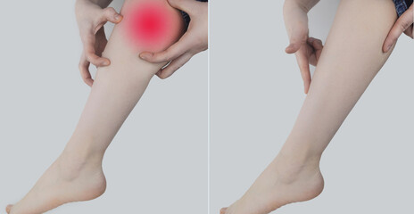Before and after. On left woman is holding on to calf muscle because it hurts a lot. On right doctors have healed the injury and there is no more pain. Ligament sprain and muscle rupture © Siniehina