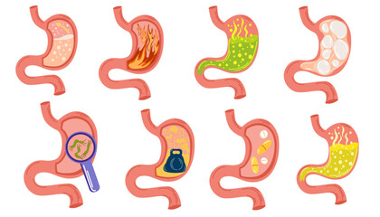 Stomach diseases set. Bloating stomach ache, digestive tract pain fullness heaviness stomach, acid heartburn process indigestion duodenum reflux. Empty and full stomach. Vector illustration
