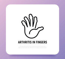 Arthritis in fingers thin line icon. Inflammation in joints. Osteoarthritis. Vector illustration.