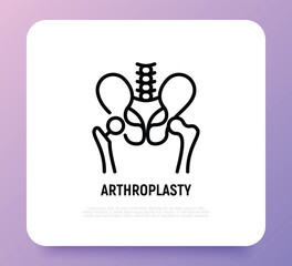 Arthroplasty thin line icon, artificial joint, surgical procedure to restore joint. Arthritis. Vector illustration.