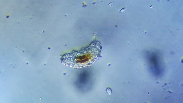Tardigrade microorganism viewed under microscope