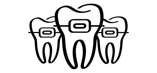 Orthodontic dental care bracket or brace. Teeth dentist, braces. Cartoon healthy, tooth with gums. Molar icon. Vector drawing damage teeth or tooth with caries. Mouth and dental, damaged. 
