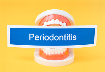 The Teeth model with Periodontitis dental disease on yellow background.