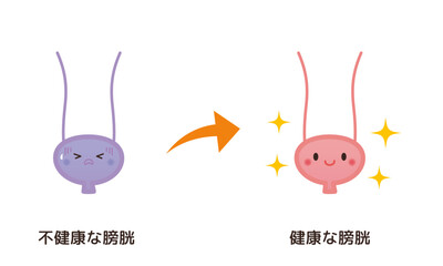 不健康な膀胱→健康な膀胱のイメージ