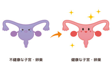 不健康な子宮・卵巣→健康な子宮・卵巣のイメージ