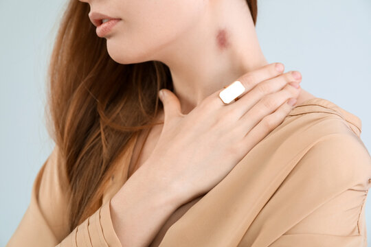 Young woman with love bite on her neck against grey background, closeup