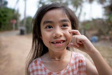 Cute asian girl missing front tooth