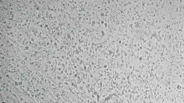 Slow motion active spermatozoa under the microscope. Sperm bank. reproductive function of man. The survival of all mankind