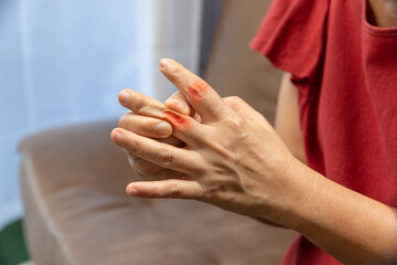 Senior Woman massage finger with painful swollen gout