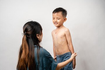 A mother is applying itching ointment to him 7 year old Asian boy suffering from chickenpox....