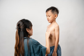 A mother is applying itching ointment to him 7 year old Asian boy suffering from chickenpox....