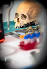 Skull adult person in murder investigation in a forensic laboratory, conceptual image