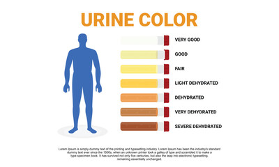 Illustration of urine color chart