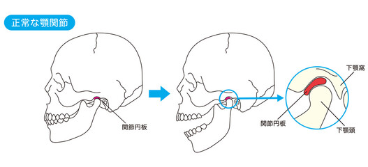 正常な顎関節　構造 - obrazy, fototapety, plakaty