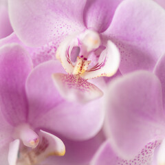 Fototapeta na wymiar Rosa Orchideen