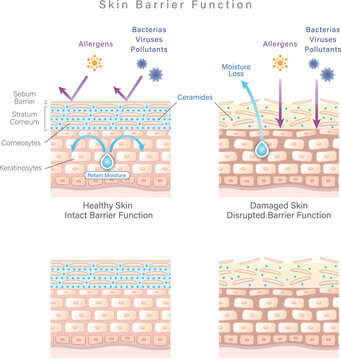 Skin anatomy/cross-section diagram explaining the skin barrier function difference between healthy skin and damaged skin.