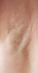 Fototapeta premium Young Woman With Hairy Armpit. Hair Removal