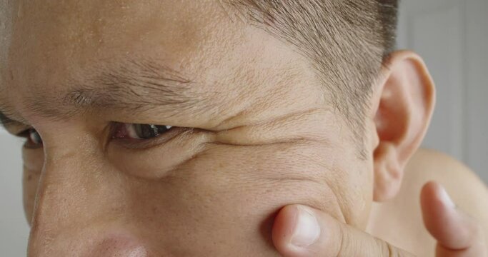 Worried Middle-aged Asian man examining wrinkles in eyes area. Unhappy Asian man dissatisfied with skin condition, thinking of professional skincare products or cosmetologist meeting.