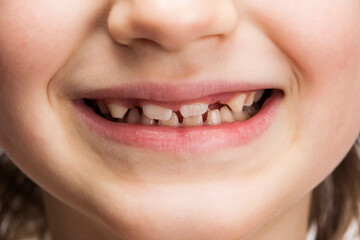 Obraz premium Six year old boy smile, showing new grown teeth, macro close up