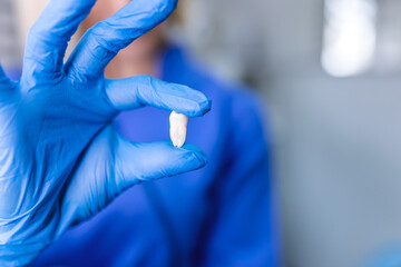 Gloved hand of dentist holding extracted tooth, close-up. Teeth whitening, dental oral hygiene, teeth restoration, dentist day