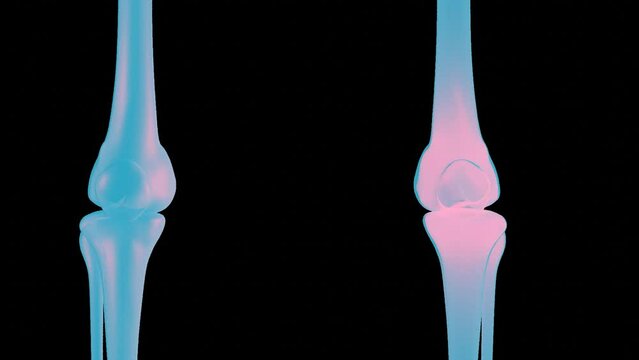 x-ray footage and close up camera to knee joint, 3d illustration rendering