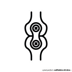Arthrodesis joint surgery thin line icon. Arthritis. Pixel perfect, editable stroke. Vector illustration.
