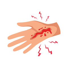 Flat Hand Injury